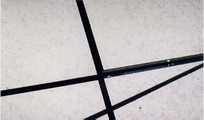 hu-hai-san-nang-ky-thuat-thuong-gap